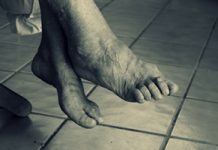 voeten_diabetes_neuropathie