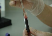 reumafactor_bloedtest_lab