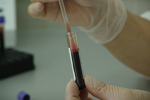 reumafactor_bloedtest_lab