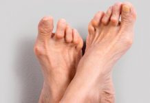 reuma-voeten